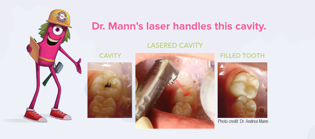 Cavity Laser